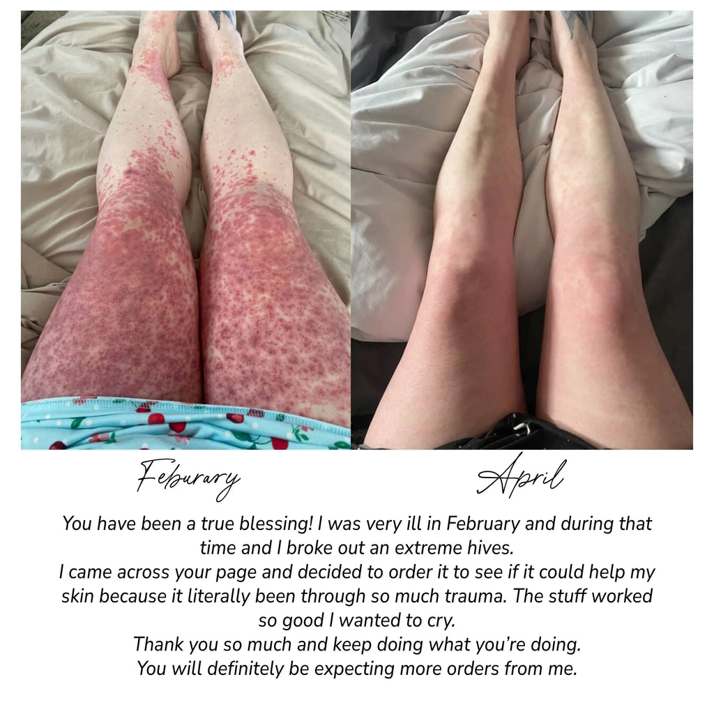 Fragrance Free Tallow + Honey Cream for Sensitive Skin Pretty farm girl