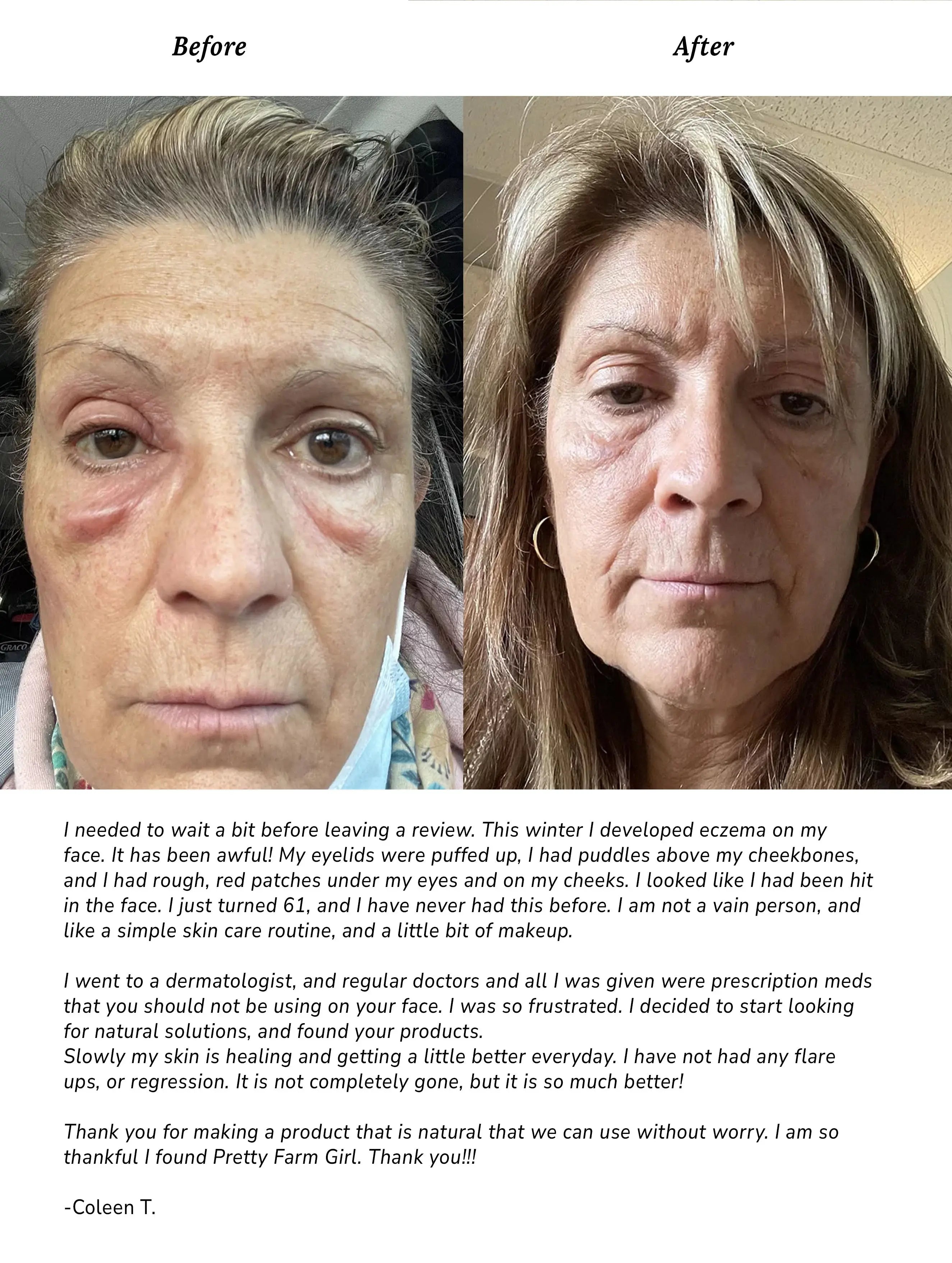 Pure + Simple Skin Kit for Sensitive Skin Pretty farm girl